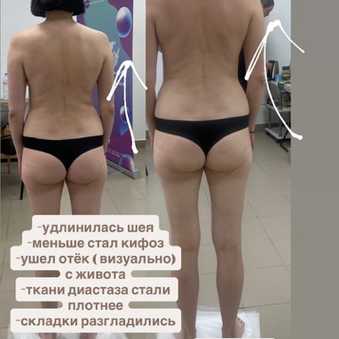 Реконструкция тела - 1